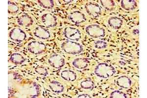 Immunohistochemistry of paraffin-embedded human small intestine tissue using ABIN7154837 at dilution of 1:100 (FAM29A anticorps  (AA 676-955))