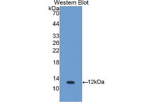 Detection of Recombinant UCN, Rat using Polyclonal Antibody to Urocortin (UCN)