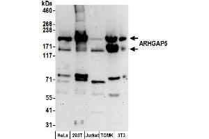 anti-rho GTPase Activating Protein 5 (ARHGAP5) (AA 1050-1100) antibody