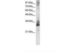 RG9MTD2 anticorps  (AA 181-230)