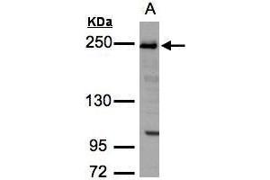 WB Image Sample(30 ug whole cell lysate) A:H1299 5% SDS PAGE antibody diluted at 1:3000 (TJP1 anticorps  (N-Term))