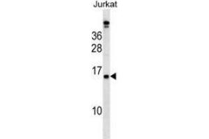 Western blot analysis in Jurkat cell line lysates (35ug/lane) using PLAC4  Antibody .