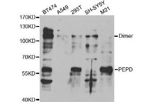 Western blot analysis of extracts of various cell lines, using PEPD antibody (ABIN5973143) at 1/1000 dilution. (PEPD anticorps)