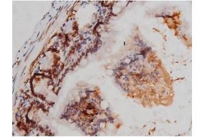 ABIN6267362 at 1/200 staining Mouse intestinal tissue sections by IHC-P. (MAPT anticorps  (pThr205))