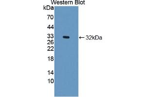 Western blot analysis of the recombinant protein. (DOCK2 anticorps  (AA 390-635))