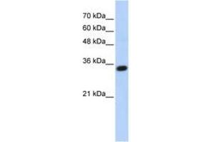 Image no. 1 for anti-Complement C1q Tumor Necrosis Factor-Related Protein 4 (C1QTNF4) (AA 107-156) antibody (ABIN6743640) (C1QTNF4 anticorps  (AA 107-156))