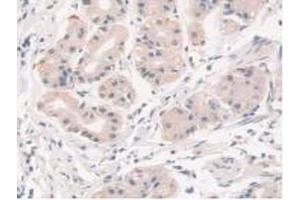 Detection of STX1A in Human Stomach Tissue using Polyclonal Antibody to Syntaxin 1A, Brain (STX1A)