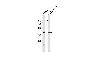 All lanes : Anti-CREB3 Antibody (C-term) at 1:8000 dilution Lane 1: HepG2 whole cell lysates Lane 2: NCI- whole cell lysates Lysates/proteins at 20 μg per lane. (CREB3 anticorps  (C-Term))