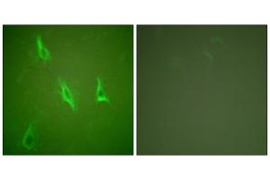 Immunofluorescence analysis of HeLa cells, using Caspase 10 antibody. (Caspase 10 anticorps  (C-Term))