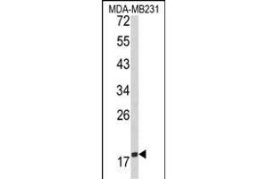 Western blot analysis of CD28 Antibody (C-term) (ABIN390970 and ABIN2841150) in MDA-M cell line lysates (35 μg/lane). (CD28 anticorps  (C-Term))