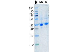 Validation with Western Blot (TIMP1 Protein (Transcript Variant 2) (His tag))