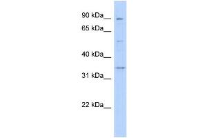 WB Suggested Anti-WNT9B Antibody Titration:  0. (WNT9B anticorps  (Middle Region))