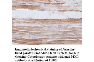 Image no. 1 for anti-Enoyl-CoA Delta Isomerase 2 (PECI) antibody (ABIN791176) (PECI/ECI2 anticorps)