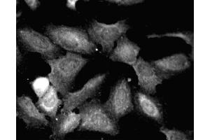 Immunofluorescent staining of HeLa (ATCC CCL-2) cells. (Paxillin anticorps  (AA 1-557))
