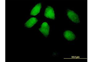 Immunofluorescence of purified MaxPab antibody to HIRA on HeLa cell. (HIRA anticorps  (AA 1-1017))