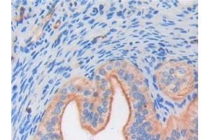 Detection of FGF6 in Mouse Ovary Tissue using Polyclonal Antibody to Fibroblast Growth Factor 6 (FGF6)