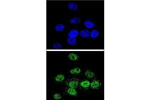 Confocal immunofluorescent analysis of MEF2A Antibody (Center) (ABIN653206 and ABIN2842748) with Hela cell followed by Alexa Fluor® 488-conjugated goat anti-rabbit lgG (green). (MEF2A anticorps  (AA 453-479))