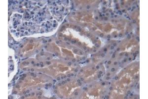 DAB staining on IHC-P; Samples: Human Kidney Tissue