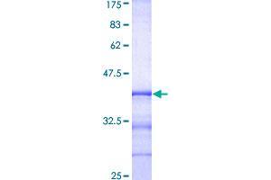 Image no. 1 for RAB8A, Member RAS Oncogene Family (RAB8A) (AA 108-207) protein (GST tag) (ABIN1317203)