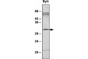 Western blot analysis of Synechocystis sp. (SppA2 anticorps)