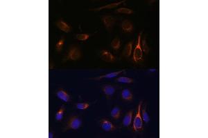 Immunofluorescence analysis of U-2 OS cells using VMP1 Polyclonal Antibody (ABIN7271283) at dilution of 1:100 (40x lens).