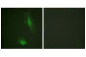 Immunofluorescence analysis of HeLa cells, using Akt (Ab-129) antibody. (AKT1 anticorps  (Ser129))