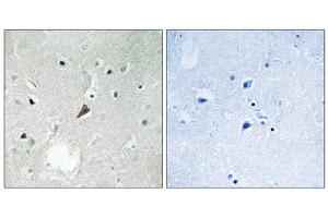 Immunohistochemistry analysis of paraffin-embedded human brain tissue using PYK2 (Phospho-Tyr579) antibody.