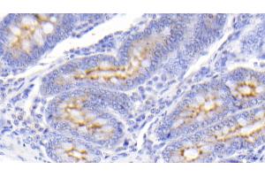 Detection of PIGR in Bovine Small intestine Tissue using Polyclonal Antibody to Polymeric Immunoglobulin Receptor (PIGR)
