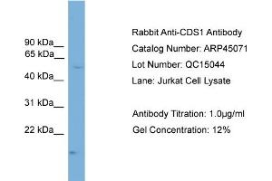 WB Suggested Anti-CDS1  Antibody Titration: 0. (CDS1 anticorps  (N-Term))