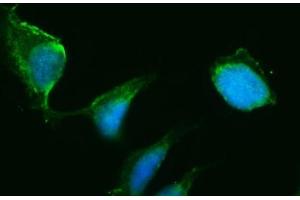 anti-Hydroxy-delta-5-Steroid Dehydrogenase, 3 beta- and Steroid delta-Isomerase 1 (HSD3B1) (AA 17-373) antibody