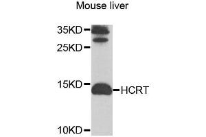 Western blot analysis of extracts of mouse liver, using HCRT antibody (ABIN6003553) at 1/1000 dilution. (Orexin anticorps)