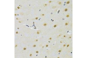 Immunohistochemistry of paraffin-embedded rat brain using DDB1 Antibody. (DDB1 anticorps)