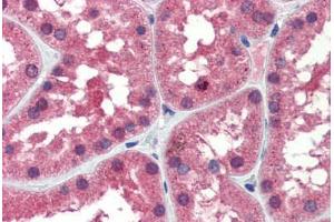 Human Kidney (formalin-fixed, paraffin-embedded) stained with IDH1 antibody ABIN462259 followed by biotinylated goat anti-rabbit IgG secondary antibody ABIN481713, alkaline phosphatase-streptavidin and chromogen.