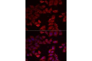 Immunofluorescence analysis of MCF7 cells using SEPHS1 antibody . (SEPHS1 anticorps  (AA 1-392))
