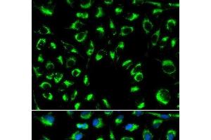 Immunofluorescence analysis of MCF-7 cells using PPP4C Polyclonal Antibody (PPP4C anticorps)