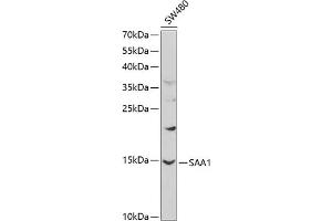 Western blot analysis of extracts of SW480 cells, using S antibody (ABIN3022330, ABIN3022331, ABIN3022332 and ABIN6218744) at 1:1000 dilution. (SAA1 anticorps  (AA 19-122))