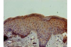 Immunohistochemistry of paraffin-embedded human skin tissue using ABIN7170811 at dilution of 1:100 (STOX1 anticorps  (AA 559-858))