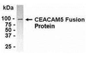 Western Blotting (WB) image for anti-Carcinoembryonic Antigen-Related Cell Adhesion Molecule 5 (CEACAM5) (AA 460-600) antibody (ABIN2468129) (CEACAM5 anticorps  (AA 460-600))