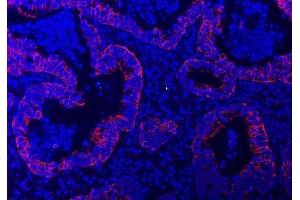 IF analysis of TRAM1L1 using anti-TRAM1L1 antibody (ABIN7602939). (TRAM1L1 anticorps  (C-Term))