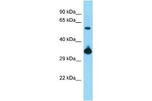 WB Suggested Anti-Bmi1 Antibody   Titration: 1. (BMI1 anticorps  (Middle Region))