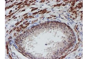 Image no. 11 for anti-ATR Interacting Protein (ATRIP) (AA 42-309) antibody (ABIN1491507)