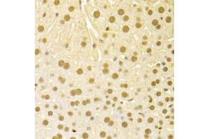Immunohistochemistry of paraffin-embedded mouse liver using SFN Antibody. (14-3-3 sigma/SFN anticorps  (AA 1-248))