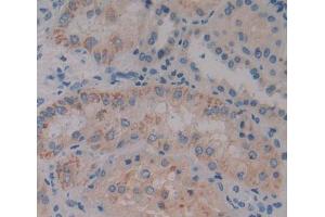 Used in DAB staining on fromalin fixed paraffin- embedded kidney tissue (BCAT1 anticorps  (AA 174-386))