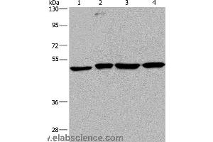 Western blot analysis of A431, HepG2, Raji and K562 cell, using CCR6 Polyclonal Antibody at dilution of 1:966 (CCR6 anticorps)