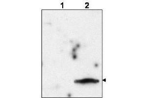 Western blot using  affinity purified anti-FIV Matrix Protein p15 to detect p15 in the culture supernatant of FIV-infected feline CrFK cells (lane 2, arrowhead). (Feline Immunodeficiency Virus Matrix (MA) (FIV p15) (Internal Region) anticorps)