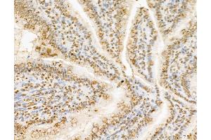 ABIN7094336 and ABIN7098383 at 1/100 staining Rat colon tissue by IHC-P. (Ceramide Synthase 2 anticorps  (C-Term))