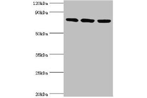 Western blot All lanes: DNA replication licensing factor MCM5 antibody at 3 μg/mL Lane 1: Hela whole cell lysate Lane 2: MCF-7 whole cell lysate Lane 2: Mouse thymus tissue Secondary Goat polyclonal to rabbit IgG at 1/10000 dilution Predicted band size: 82 kDa Observed band size: 82 kDa (MCM5 anticorps  (AA 1-230))