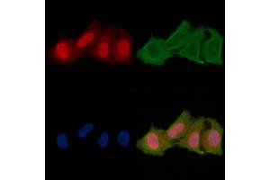 ABIN6256701 and ABIN6278650 staining Hela cells(24h of starvation treatment) by IF/ICC.