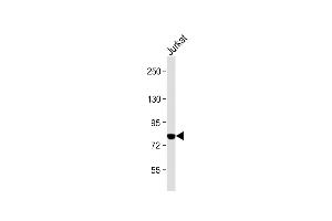 Anti-PKC theta Antibody (C-term) at 1:2000 dilution + Jurkat whole cell lysate Lysates/proteins at 20 μg per lane. (PKC theta anticorps  (C-Term))