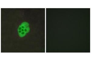 Immunofluorescence analysis of MCF-7 cells, using HTR4 antibody. (Serotonin Receptor 4 anticorps  (Internal Region))